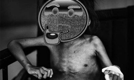 Niños son rescatados por desnutrición en Izabal