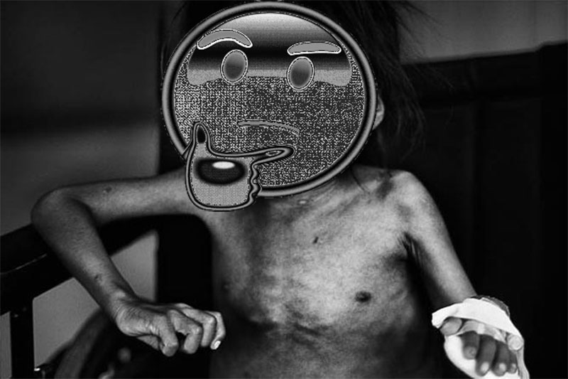 Niños son rescatados por desnutrición en Izabal