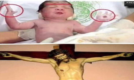 Un niño nació con un mensaje en las manos y en la frente, de cuando será la venida de Jesucristo