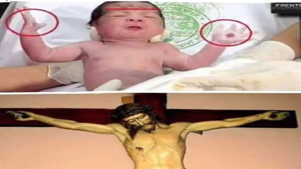 Un niño nació con un mensaje en las manos y en la frente, de cuando será la venida de Jesucristo