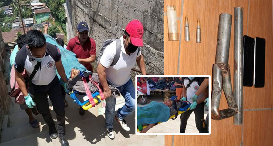 COATEPEQUE: Joven agredió a su abuela de 72 años porque no le dio dinero para comprar drogas