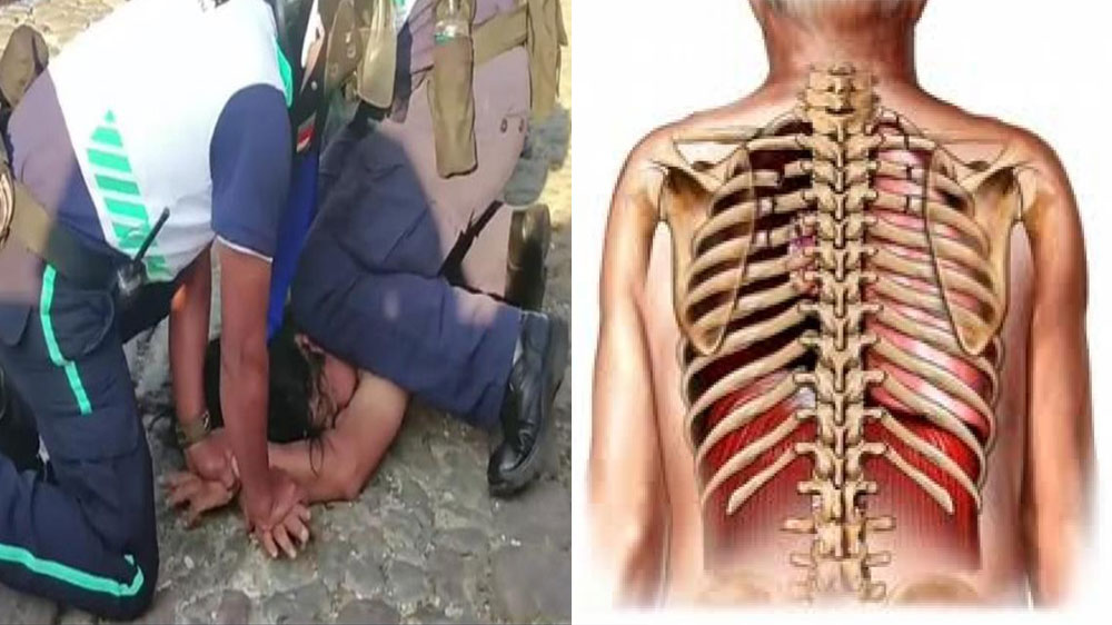 Inacif revela las causas de muerte de hombre agredido por PMT en Antigua
