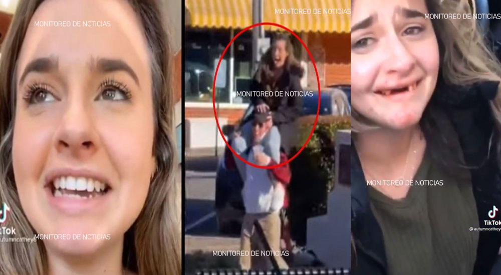 Joven se queda sin dientes por hacer reto en Tiktok (Video)