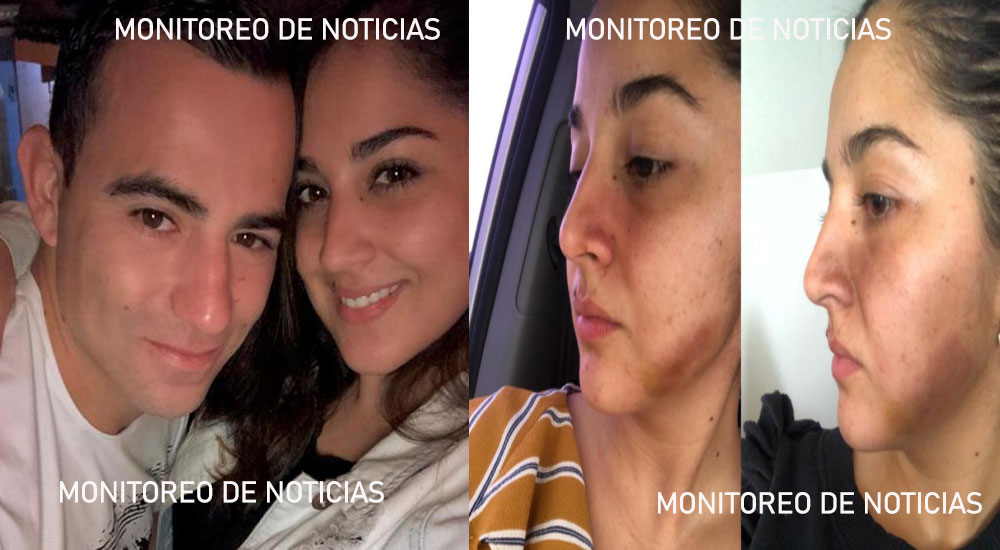 Aparicio denuncia por tercera vez a Marco Pappa por agresión dentro de la cárcel