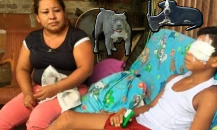 Dos perros pitbull ataca a un niño, lo deja sin el ojo izquierdo y con heridas graves