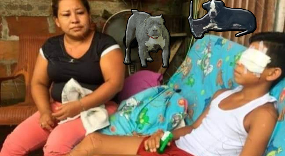 Dos perros pitbull ataca a un niño, lo deja sin el ojo izquierdo y con heridas graves