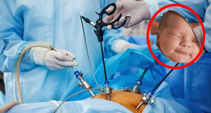“Mala práctica” Mujer da a Luz con cesárea, bebé recibe fuertes heridas con el Bisturí y muere