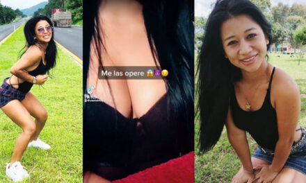 “Me las operé” Esme La Chapina se opera los senos (Video)