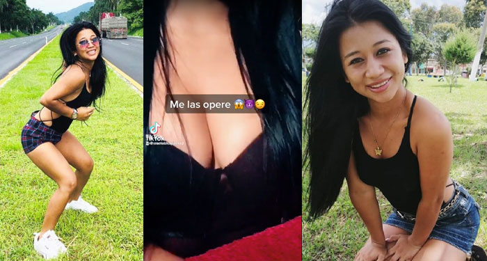 “Me las operé” Esme La Chapina se opera los senos (Video)