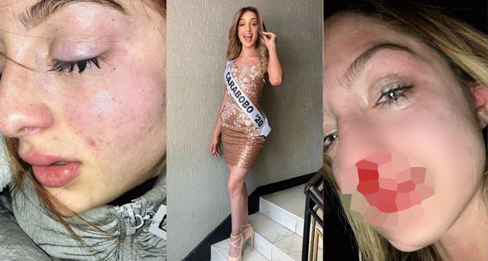 “Fui golpeada muchas veces” Momento en que una mujer es golpeada por su pareja dentro del vehículo (Video)
