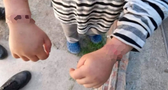 Mujer mantenía amarrado a su hijo, excusándose que el menor se “Portaba Mal”