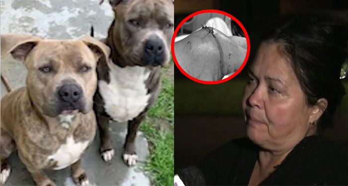 Madre apuñala a dos perros pitbull que atacaban a su hija de 1 año (Video)