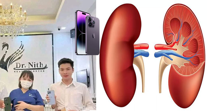 Clínica Médica ofrece el IPhone 14 a cambio de un riñón y se vuelve viral