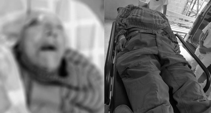 Hombre de la tercera es arrollado por vehículo y pierde la vida
