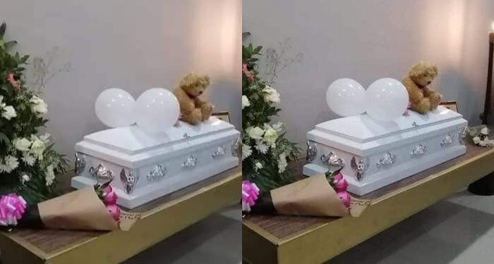 Niña de 3 años pierde la vida por sobredosis de anestesia Bucal