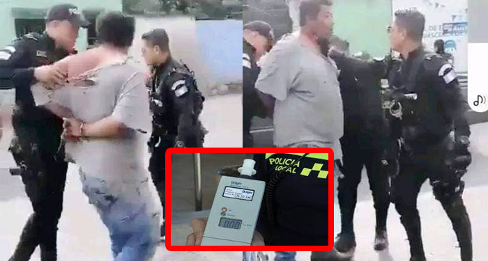 Hombre que fue golpeado por agentes de la PNC salió negativo al examen del alcoholímetro