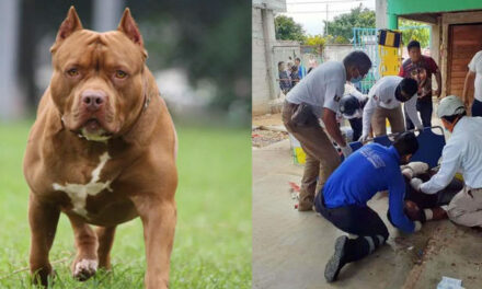 Perro de raza Pitbull atacó brutalmente a ladrón que entró a la casa de sus dueños