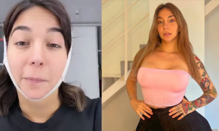Influencer sufrió una parálisis facial al realizarse una lipopapada (Video)