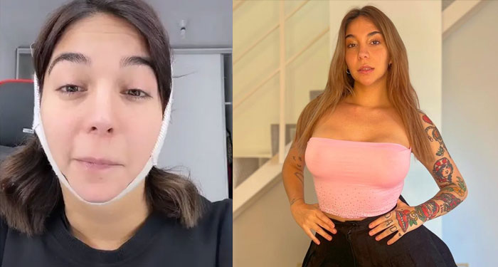 Influencer sufrió una parálisis facial al realizarse una lipopapada (Video)