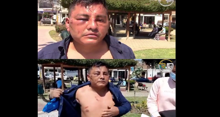 Hombre es amarrado y golpeado por su suegra porque jamás aceptó la relación con su hija (Vídeo)